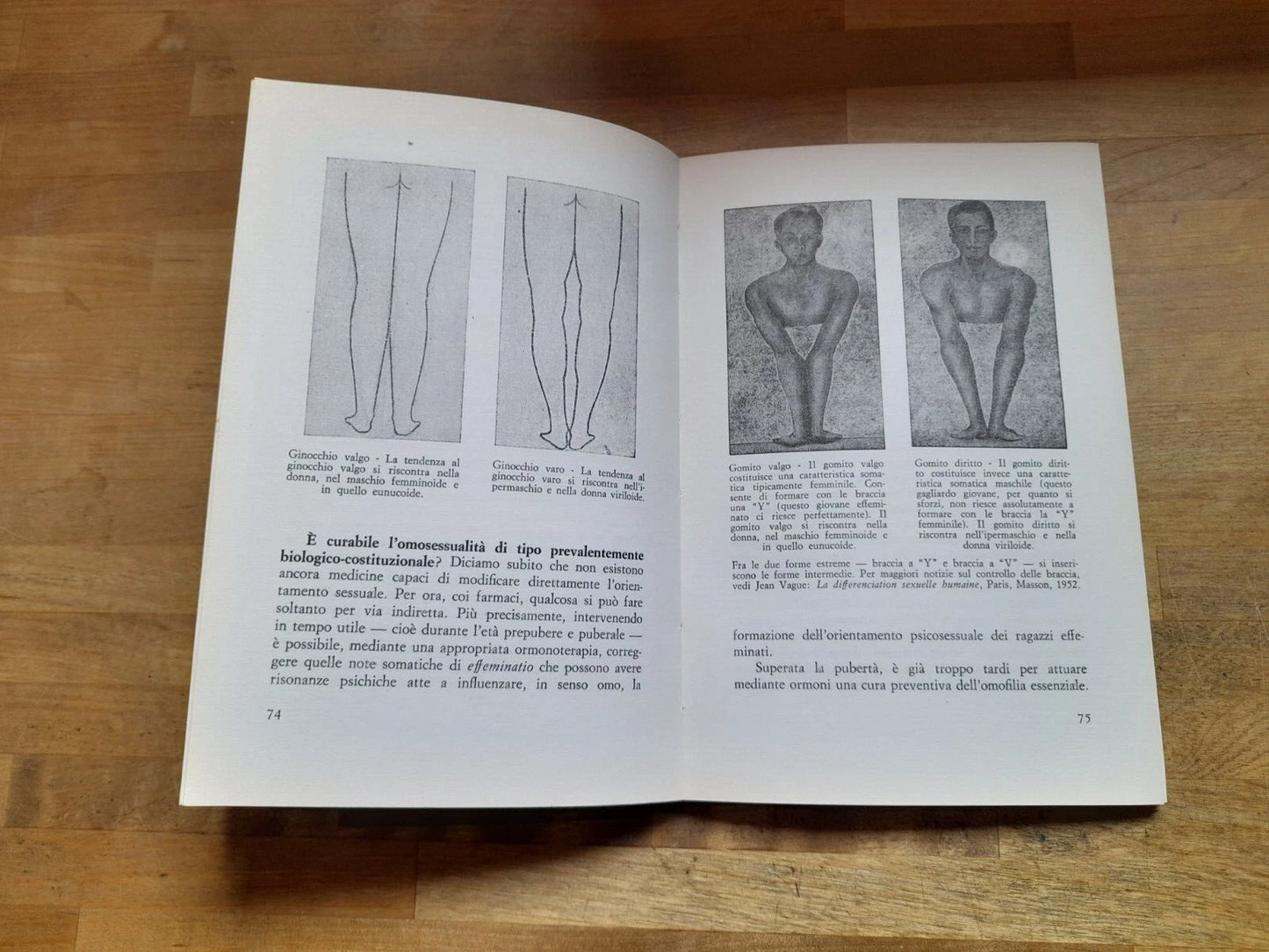 BISESSUALITA' NUOVA FRONTIERA DELL'EROS. GINO OLIVARI. TODARIANA EDITRICE. 2° EDIZIONE 1983. COLLANA: "LUOGHI SAGGISTICI".