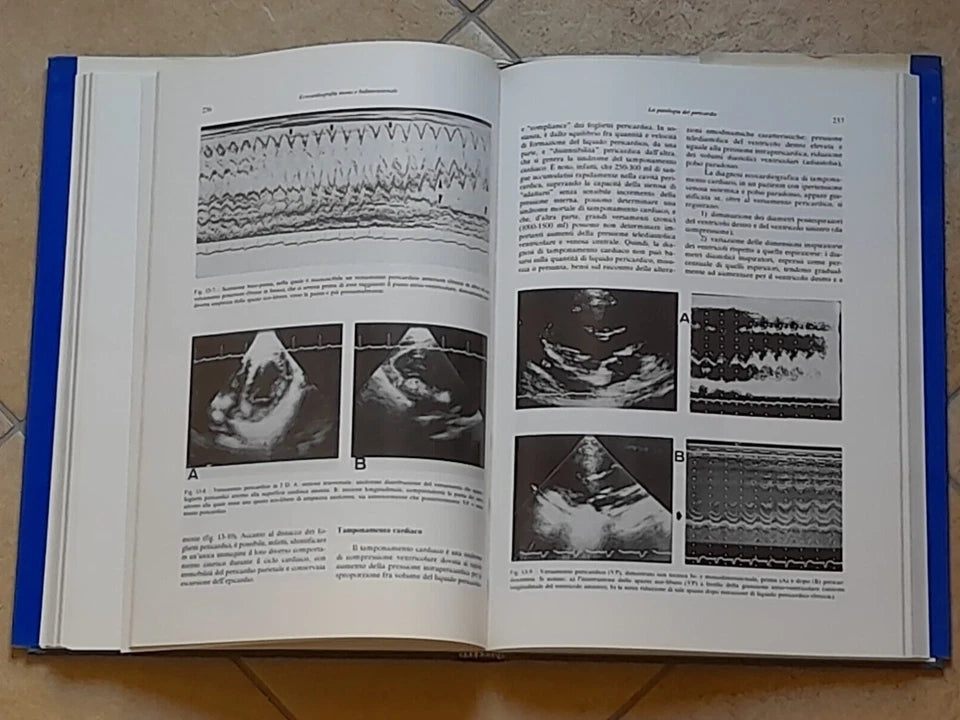 ECOCARDIOGRAFIA MONO E BIDIMENSIONALE. BOCCANELLI - GAMBELLI. IL PENSIERO SCIENTIFICO EDITORE. RISTAMPA RIVEDUTA E CORRETTA 1982.