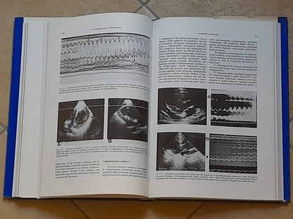 ECOCARDIOGRAFIA MONO E BIDIMENSIONALE. BOCCANELLI - GAMBELLI. IL PENSIERO SCIENTIFICO EDITORE. RISTAMPA RIVEDUTA E CORRETTA 1982.