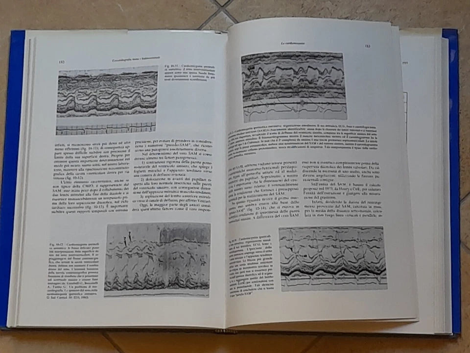 ECOCARDIOGRAFIA MONO E BIDIMENSIONALE. BOCCANELLI - GAMBELLI. IL PENSIERO SCIENTIFICO EDITORE. RISTAMPA RIVEDUTA E CORRETTA 1982.