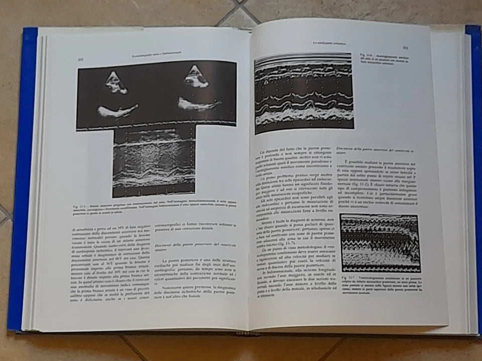 ECOCARDIOGRAFIA MONO E BIDIMENSIONALE. BOCCANELLI - GAMBELLI. IL PENSIERO SCIENTIFICO EDITORE. RISTAMPA RIVEDUTA E CORRETTA 1982.