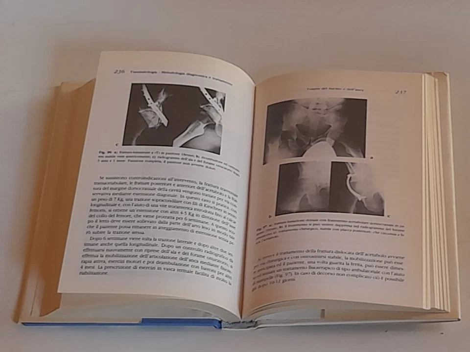 TRAUMATOLOGIA. METODOLOGIA DIAGNOSTICA E TRATTAMENTO. EUGEN H. KUNER. RISTAMPA DELLA PRIMA EDIZIONE ITALIANA RIVEDUTA E CORRETTA, 1994.